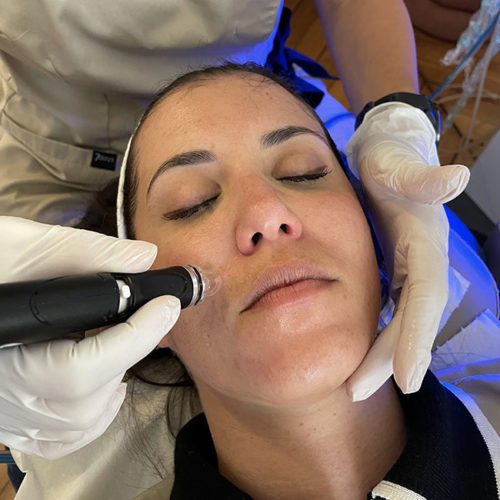 Hydrafacial - Dr Obadia Hydrafacial - Dr Obadia