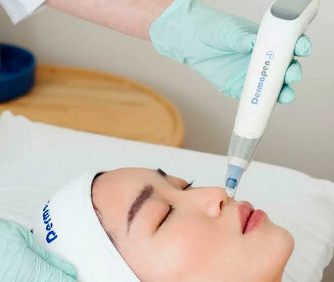 Microneedling par Dermapen