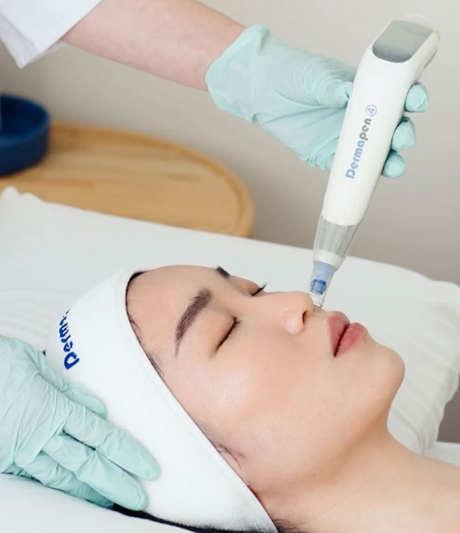 Microneedling par Dermapen